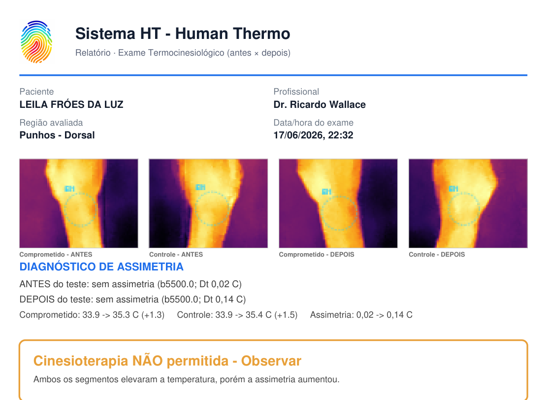 Laudo termocinesiológico
