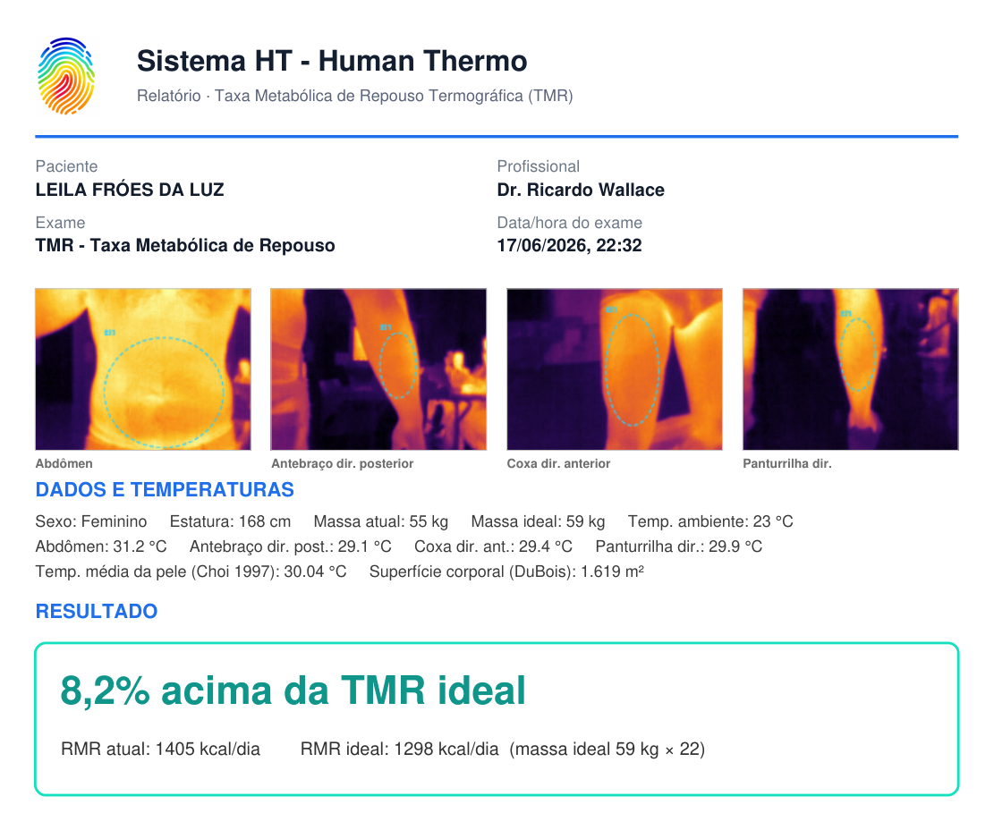 Laudo TMR